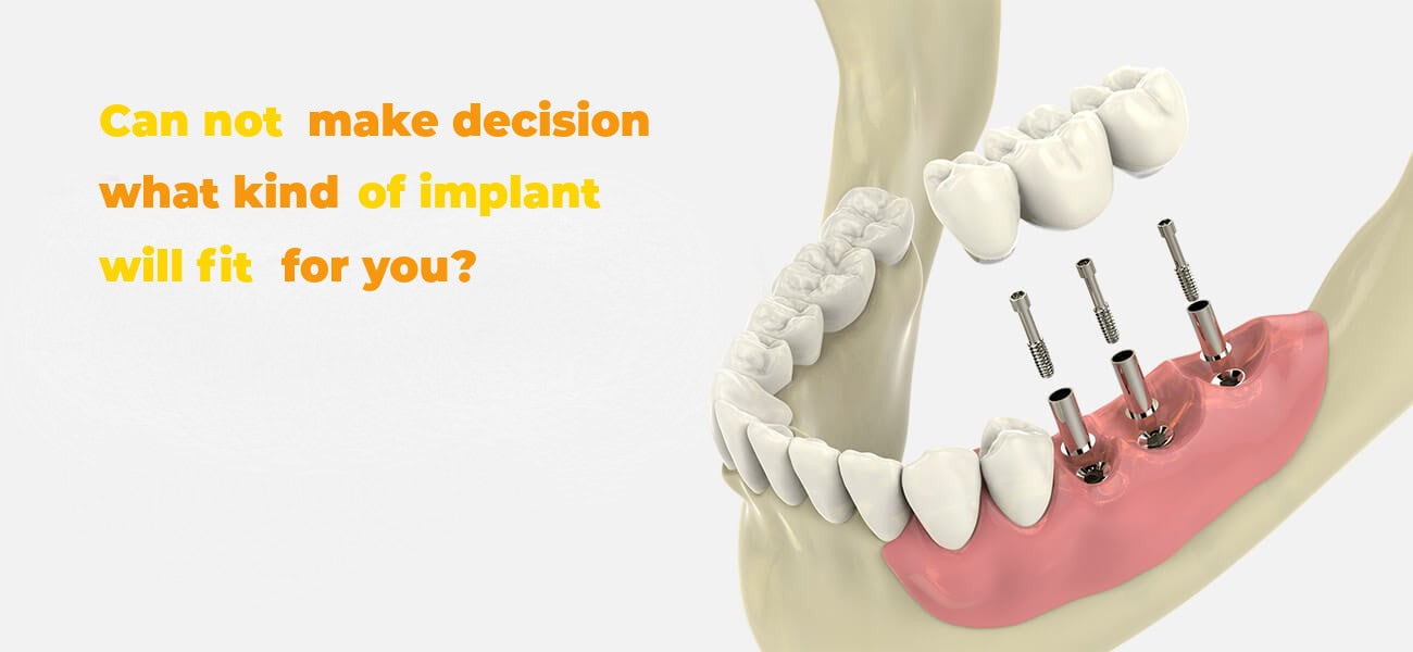 Dental Implants Budapest, immediate implants in Hungary
