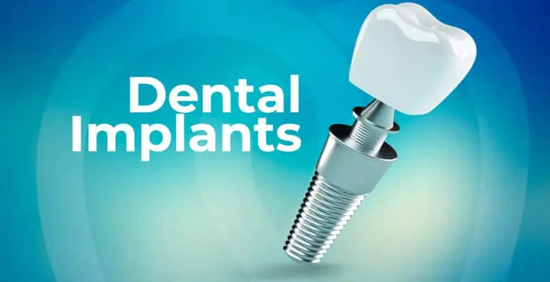 benefits of dental implant